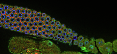 Coordination of DNA damage response and aging by ubiquitin signaling