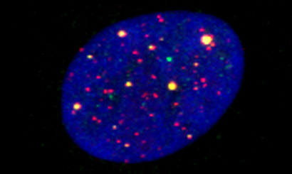 Mechanism and consequences of SLX4IP- and ERCC1-XPF-dependent telomere dysfunction