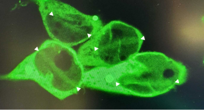 Ubiquilins in DNA repair and neurodegeneration